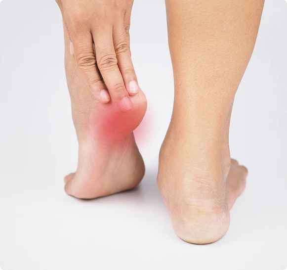 What Is a Heel Spur Treatment Novi Banner