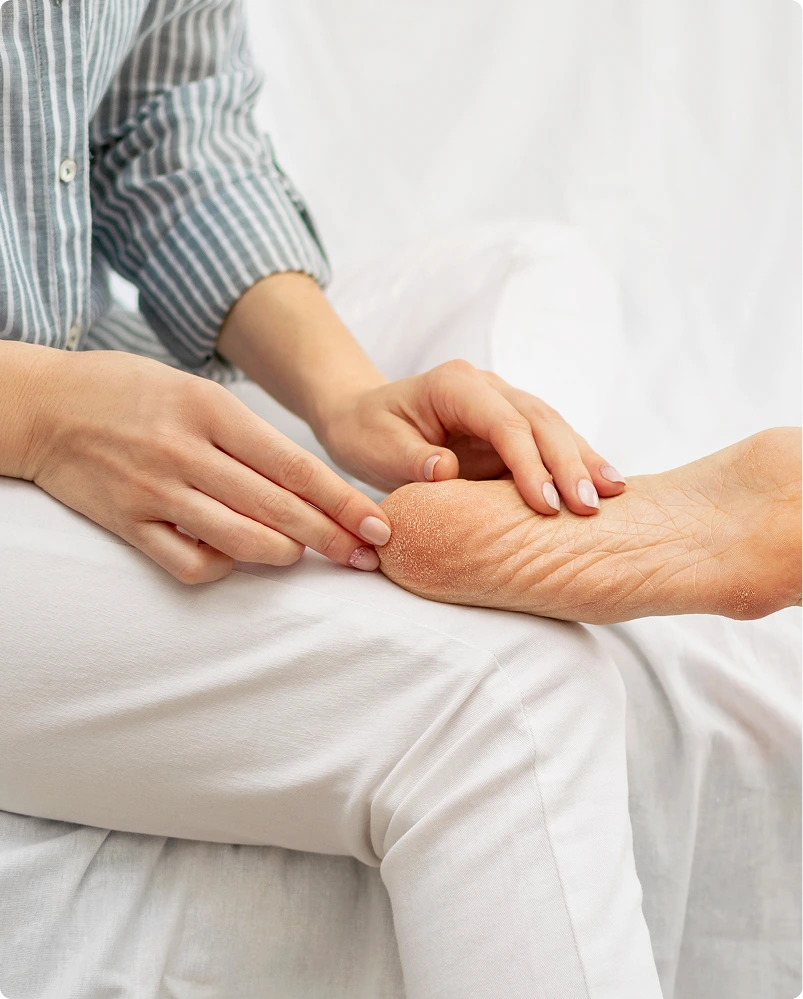 Treatments for Cracked Heels in Novi, Michigan Banner