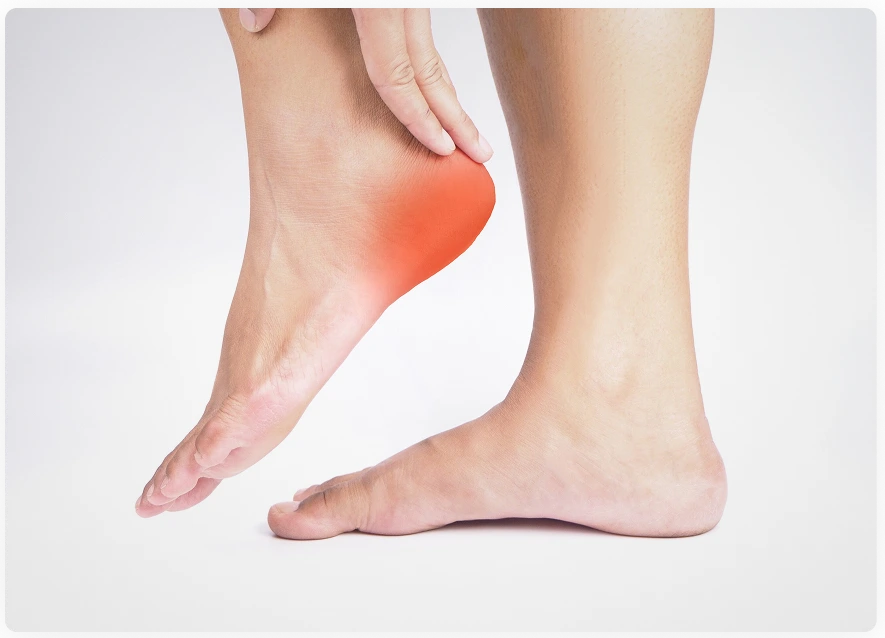 Preparation for Plantar Fasciitis Treatment Banner