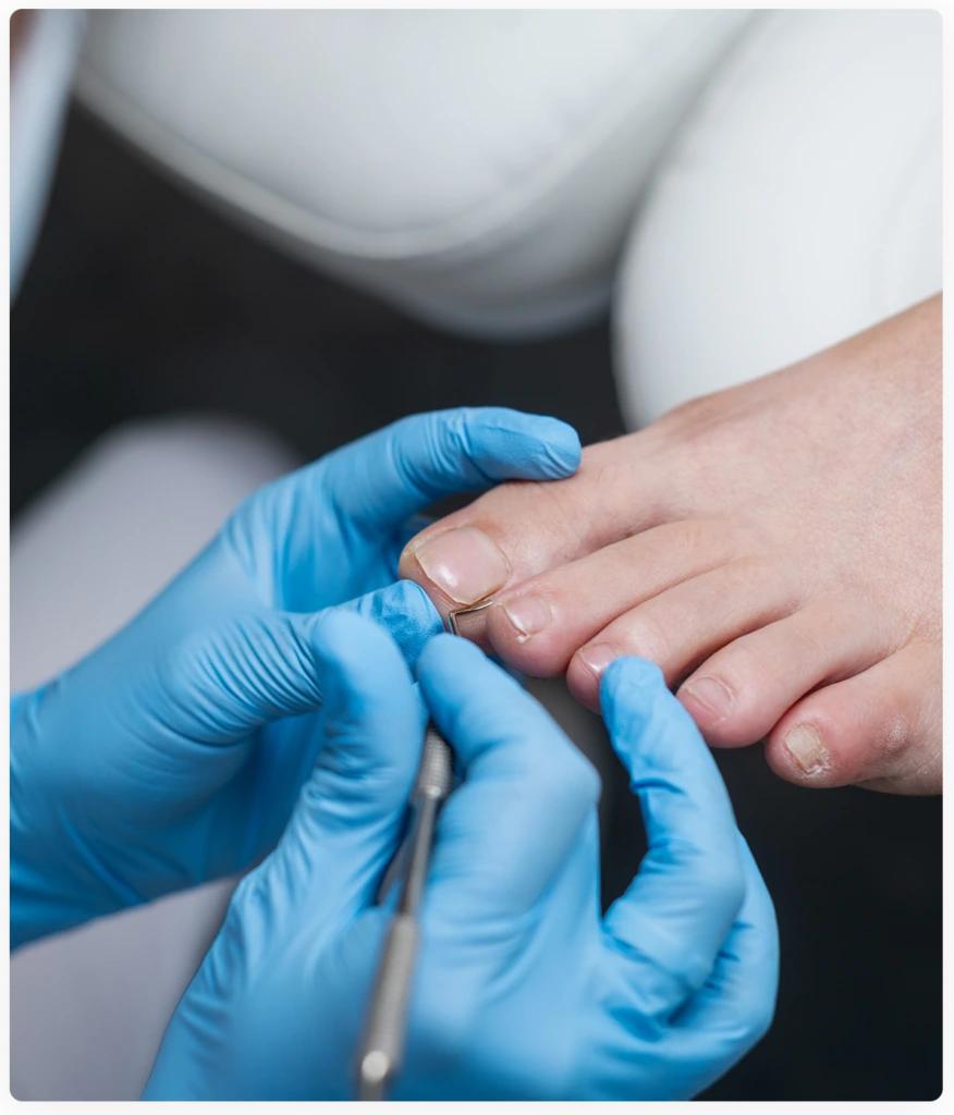 Nail Fungus Removal Novi, Livonia, Howell, Southfield: How Is Nail Fungus Diagnosed? Banner