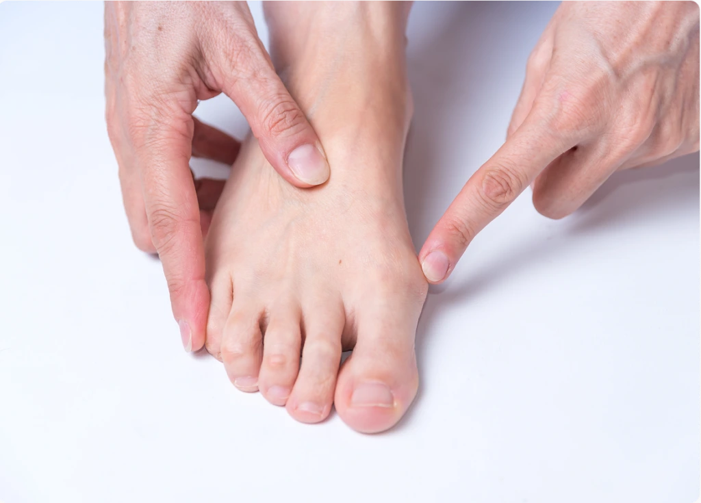 Bunion Surgery in Novi, Livonia, Howell, Southfield: What Are Bunions (Hallux Valgus)? Banner