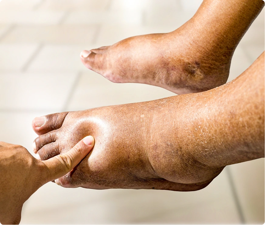 Potential Problems Associated with Diabetic Foot Specialist in Novi, MI Banner