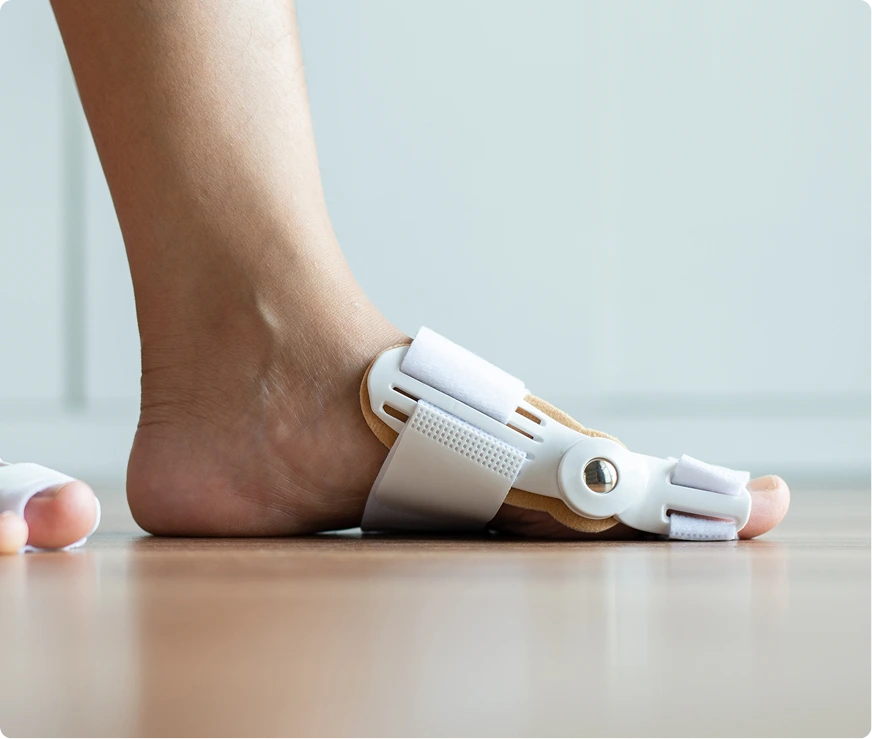 Our Treatment Options Hallux Rigidus Surgery Novi, MI Banner