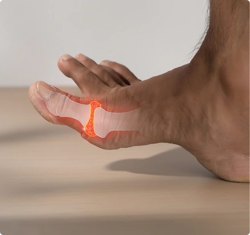 What Is Hallux Rigidus Treatment Novi, MI Banner