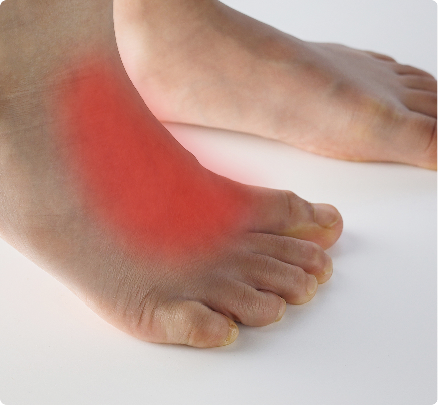 Freiberg’s Disease Treatment in Novi, MI Banner