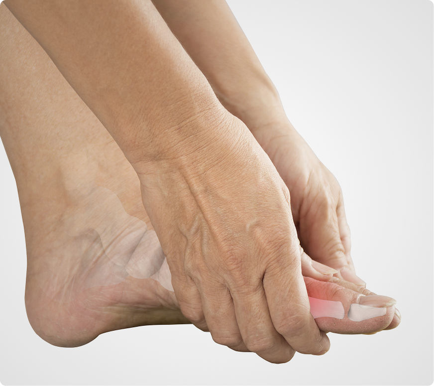 Freiberg’s Disease Treatment in Novi Banner